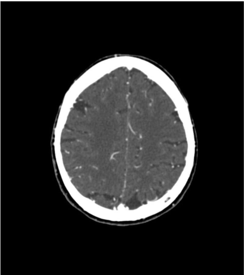Anatomy Phantom Models for CT, X-Ray, and Radiation Therapy