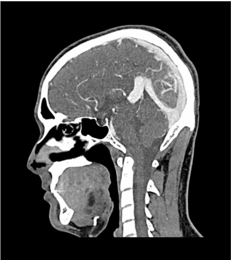 Anatomy Phantom Models for CT, X-Ray, and Radiation Therapy
