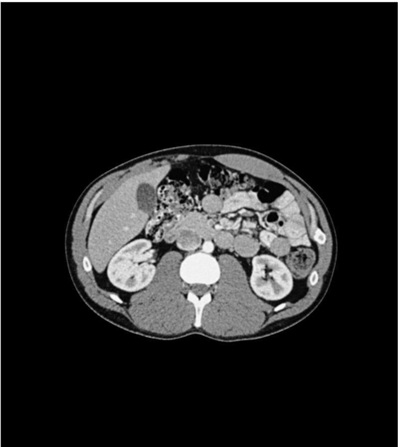 Anatomy Phantom Models for CT, X-Ray, and Radiation Therapy