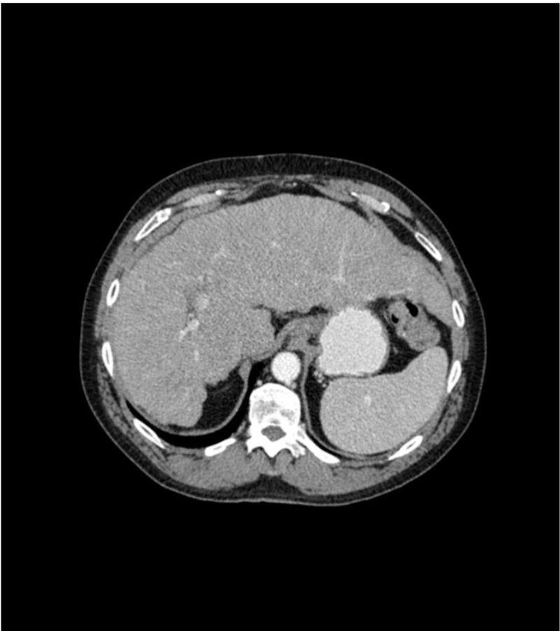 Anatomy Phantom Models for CT, X-Ray, and Radiation Therapy