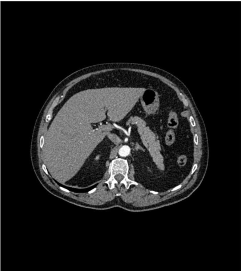 Anatomy Phantom Models for CT, X-Ray, and Radiation Therapy
