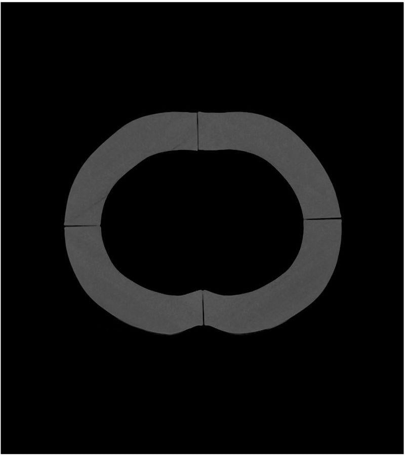 Fat Rings for Abdomen Phantom