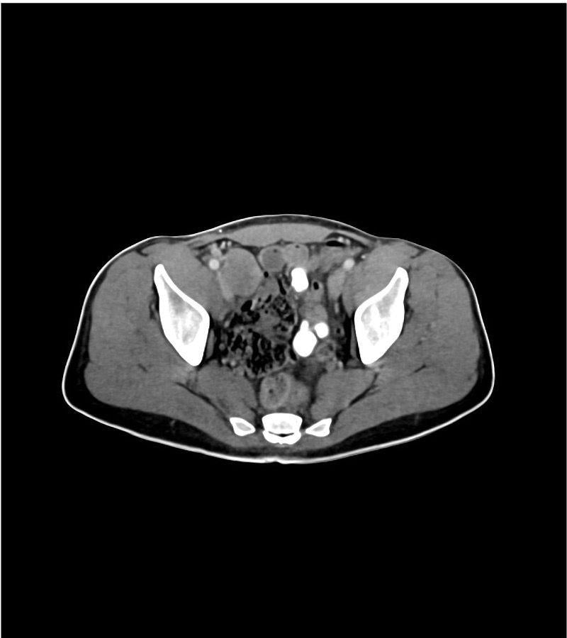 Anatomy Phantom Models for CT, X-Ray, and Radiation Therapy