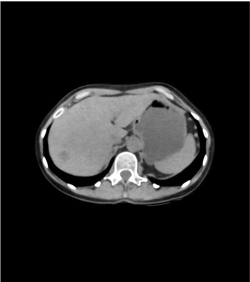Anatomy Phantom Models for CT, X-Ray, and Radiation Therapy