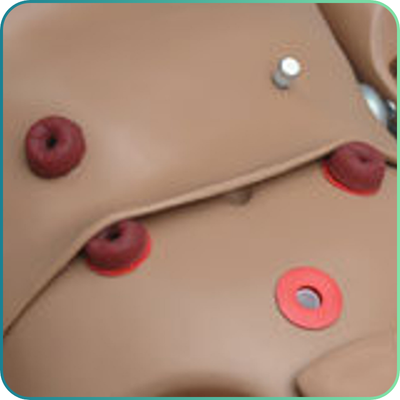 Ostomy Care
