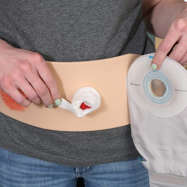 Ostomy Pouching Trainer