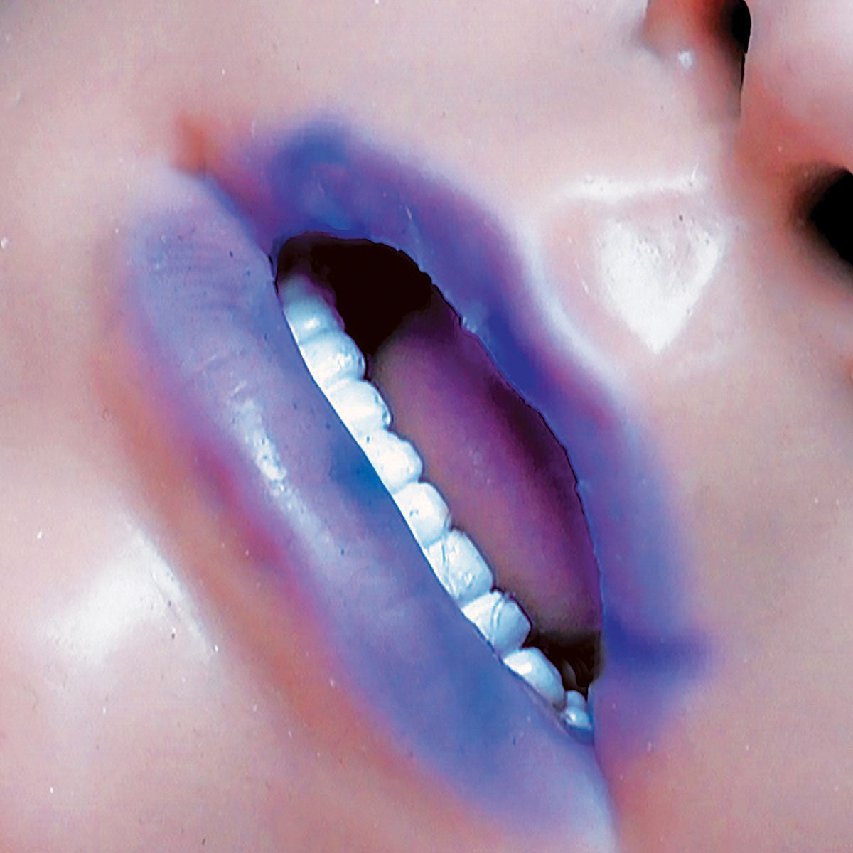 Patient with Cyanosis