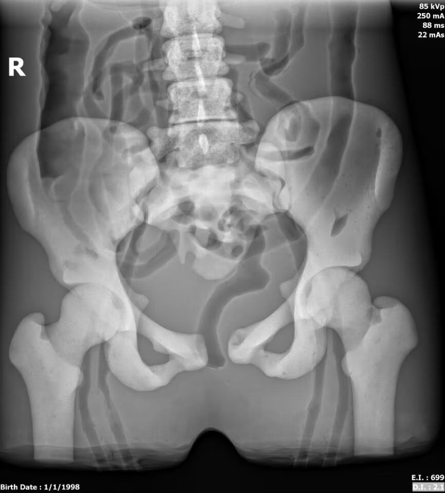 Adult Female Torso Phantom for X-Ray CT, MRI