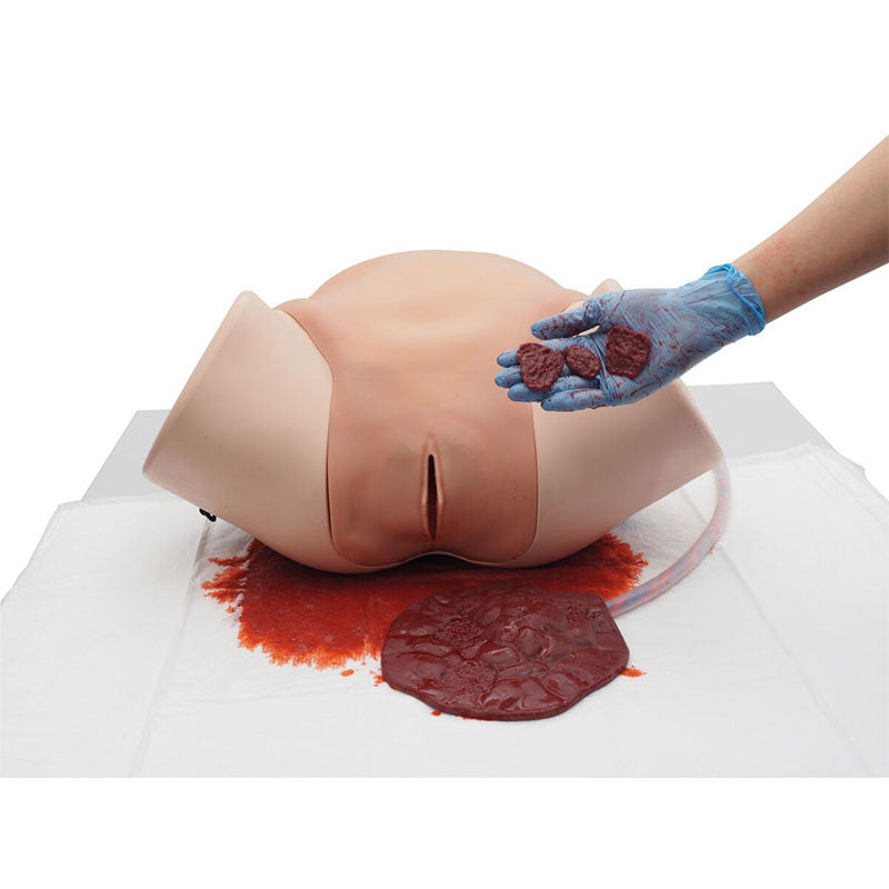 Postpartum haemorrhage retained placenta training model