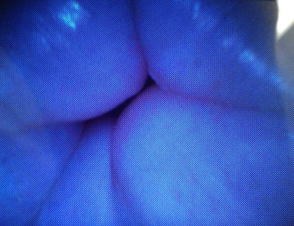 "Michael Angelo (Mikey) K9" Canine Endoscopy Simulator