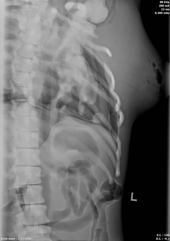 Adult Female Torso Phantom for X-Ray CT, MRI