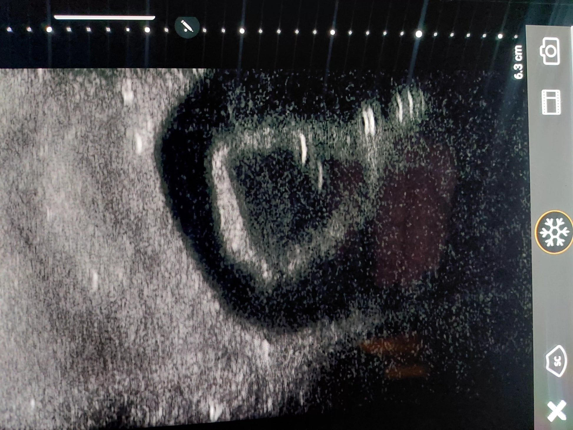 SonoEZ Ultrasound Trainer - Canine Kidney