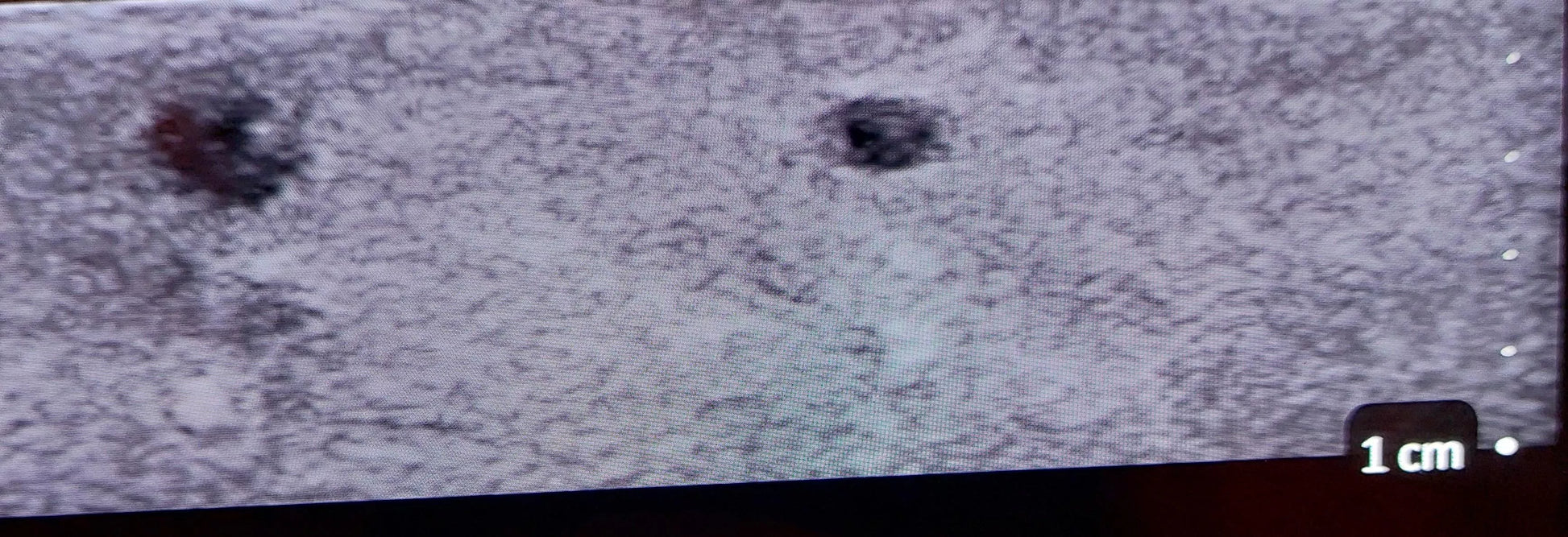 SonoEZ Paediatric Ultrasound Trainers