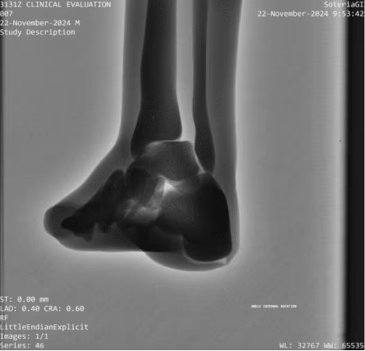 Adult Full Body Phantom for X-Ray CT, MRI