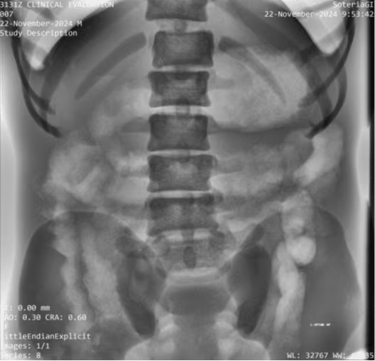 Adult Full Body Phantom for X-Ray CT, MRI