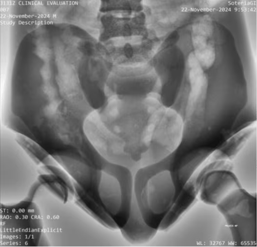 Adult Full Body Phantom for X-Ray CT, MRI