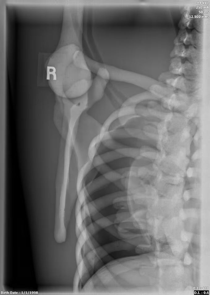 Adult Female Torso Phantom for X-Ray CT, MRI