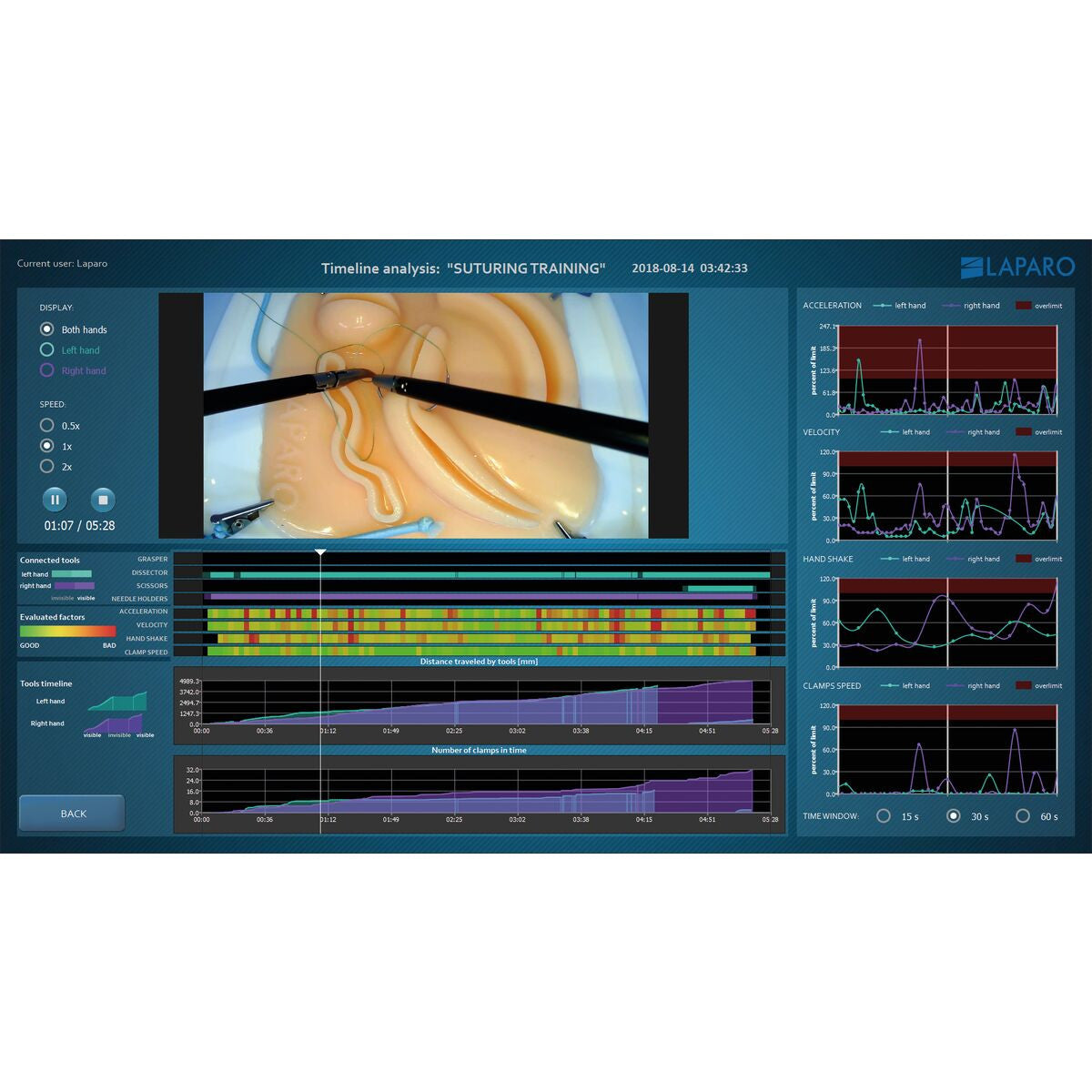 Laparo Analytic - Laparoscopic Surgical Skill Trainer with Full Training Analysis (Multi-User)