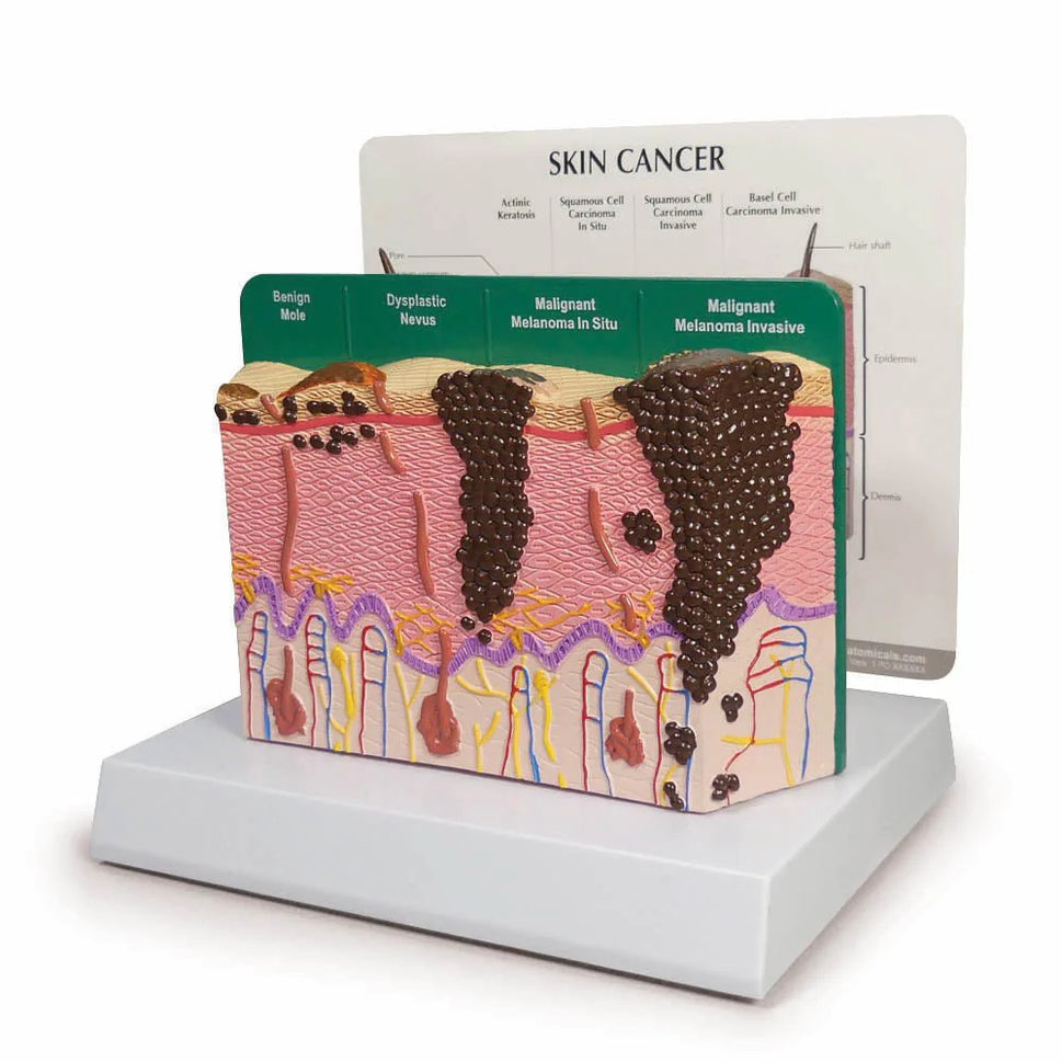 Skin Cancer Model (8 Skin Conditions)