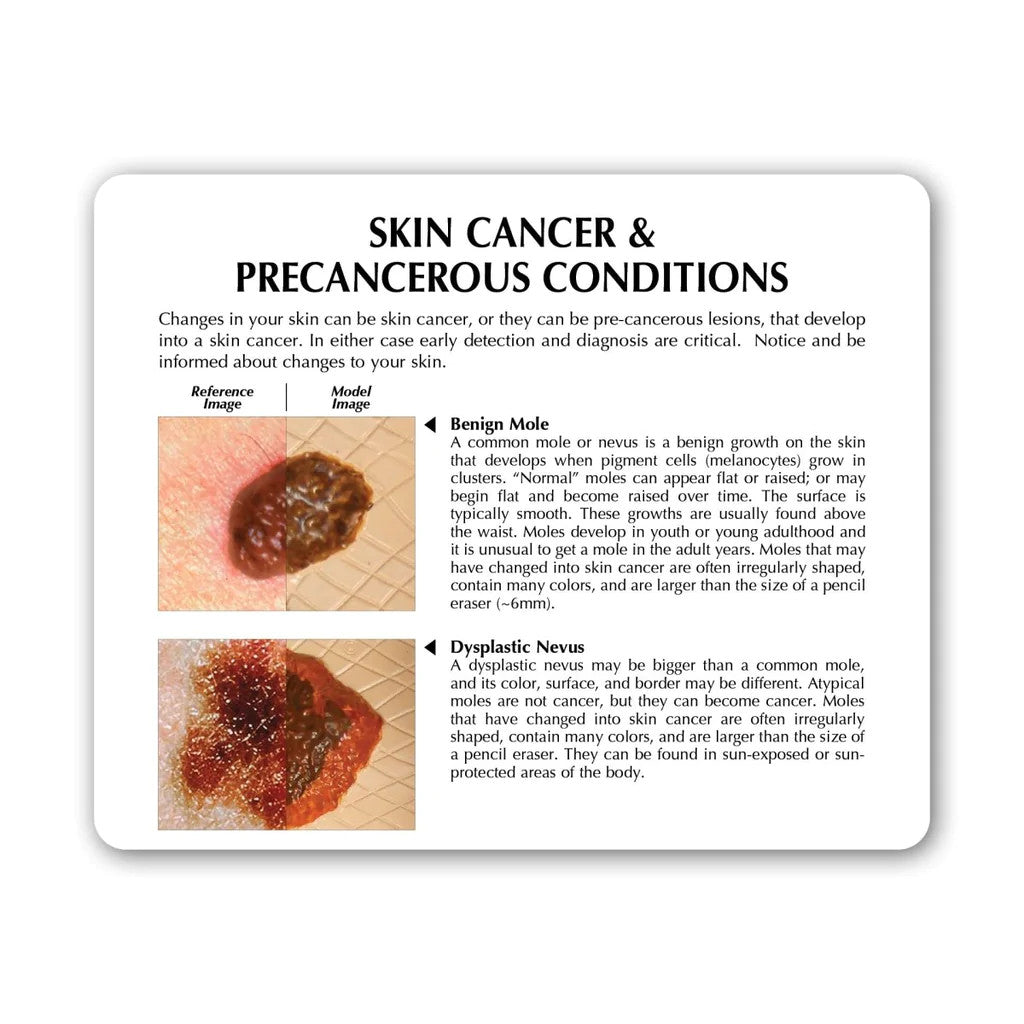 Skin Cancer Model (8 Skin Conditions)