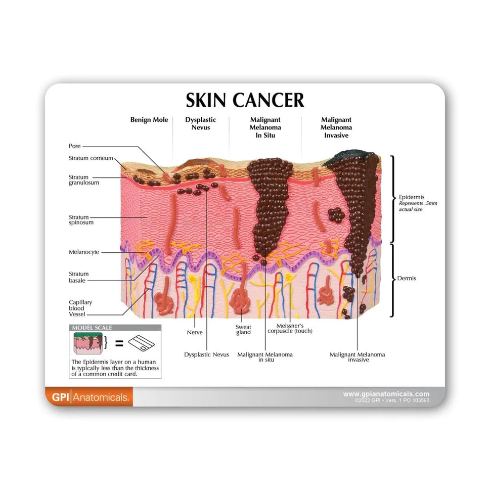 Skin Cancer Model (8 Skin Conditions)