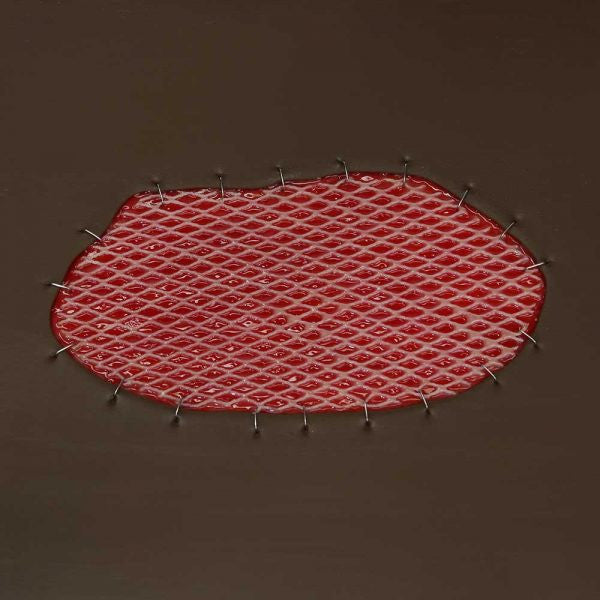 VATA Skin Graft Wound Board