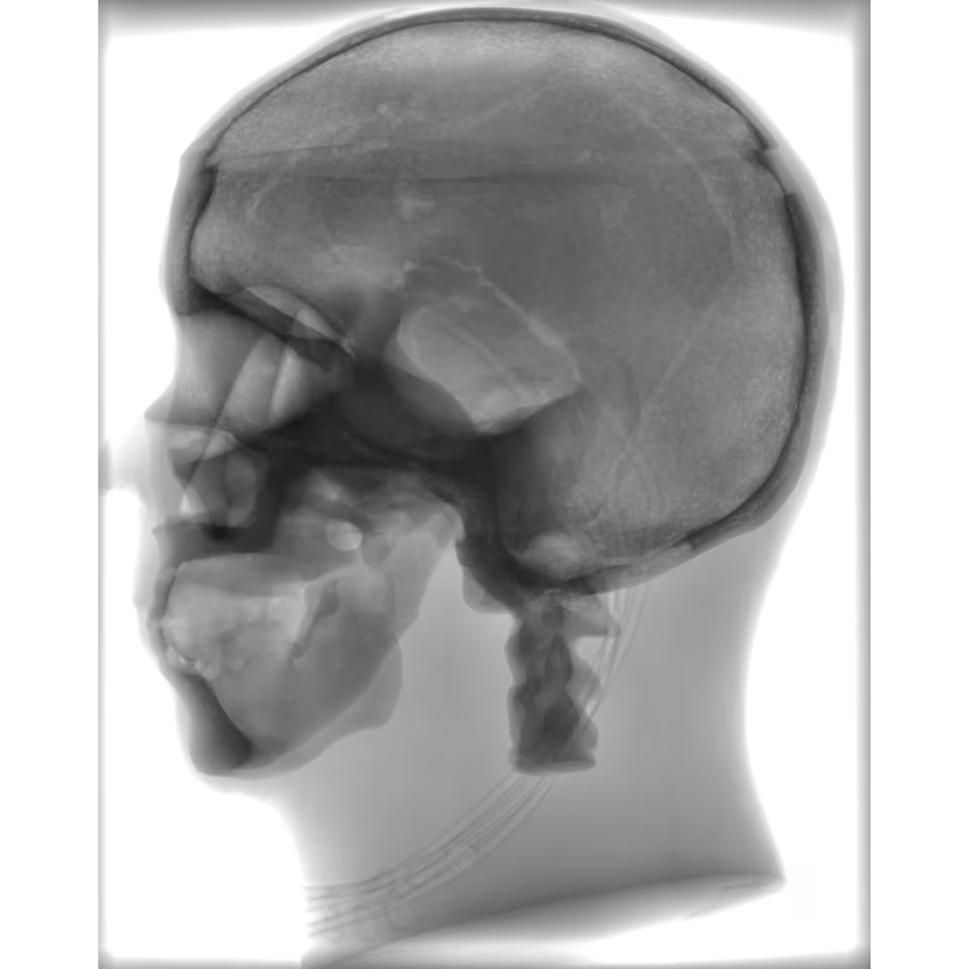Adult Skull Phantom for X-Ray CT, US, MRI