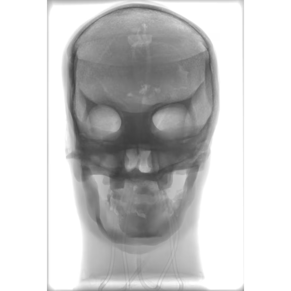 Adult Skull Phantom for X-Ray CT, US, MRI