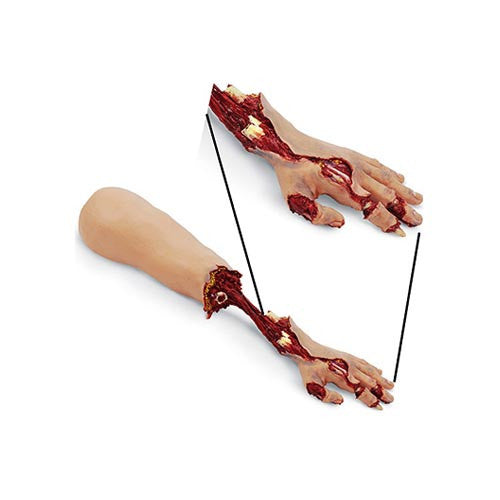 Smart Stat Xtreme Trauma Bleeding Arm