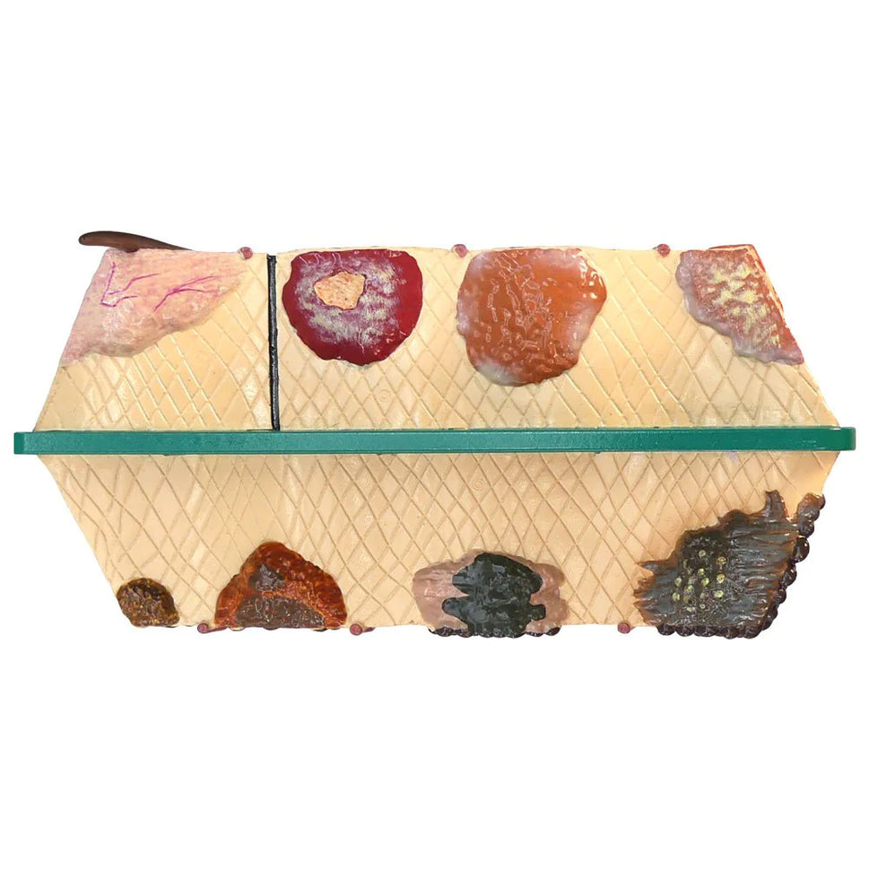 Skin Cancer Model (8 Skin Conditions)