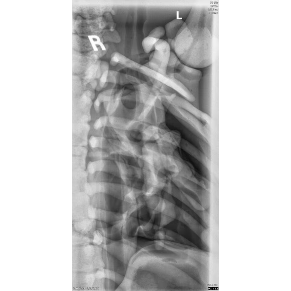 Adult Female Torso Phantom for X-Ray CT, MRI