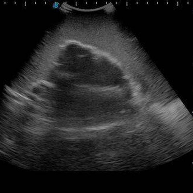 Ultrasound Training Model For Knee Arthrocentesis