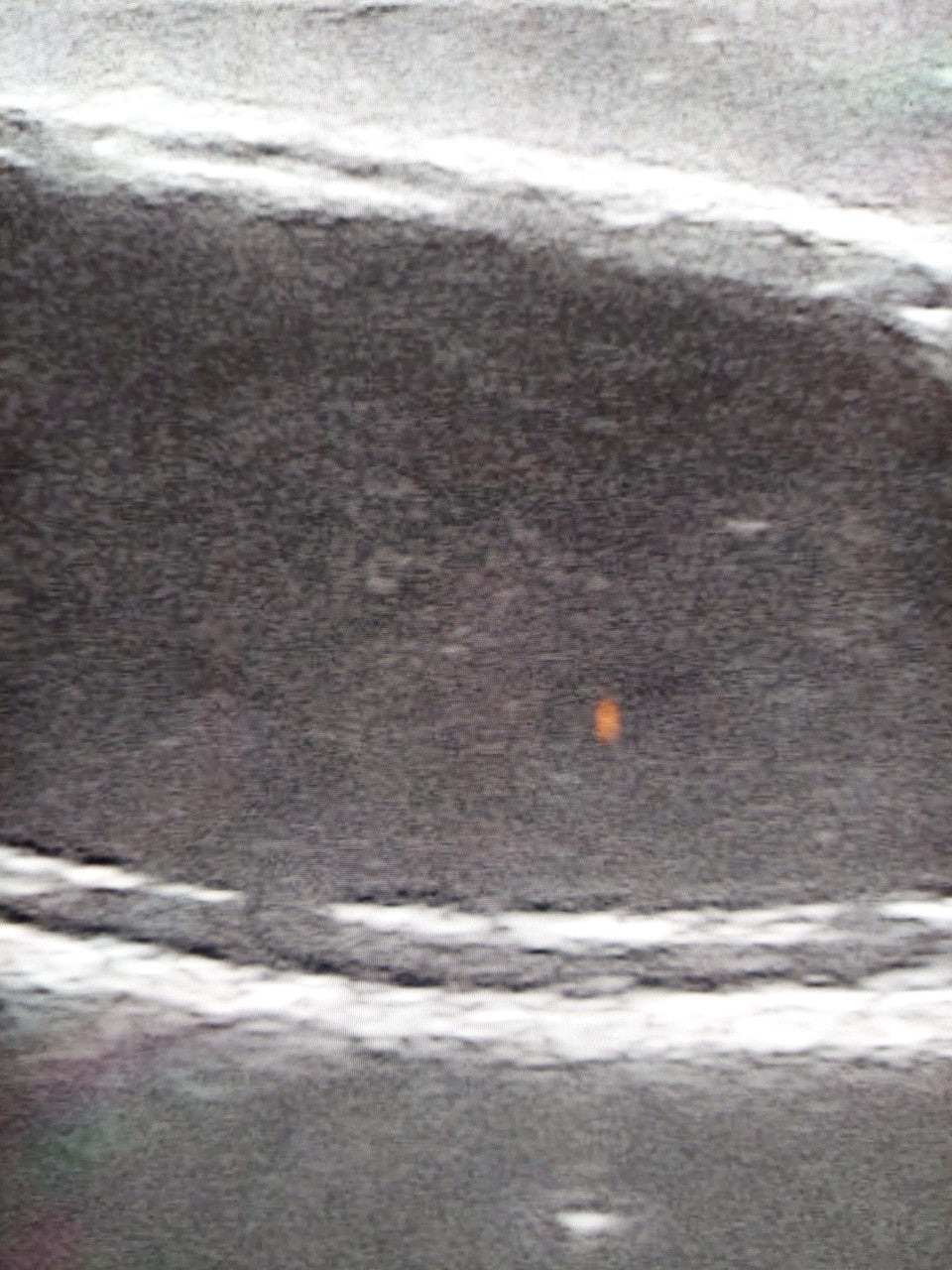 Canine Bladder Ultrasound Simulator