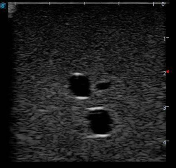 Femoral Arteriovenous Puncture and Abdominocentesis Ultrasound Training Model