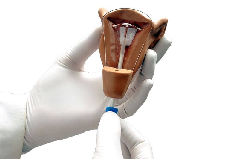 Uterus IUD Placement Model