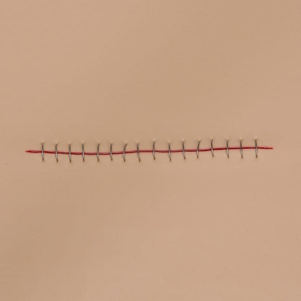 VATA Stapled Incision Wound Board