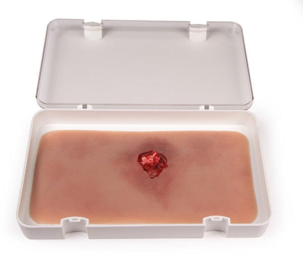 Wound Moulage with Bleeding Function