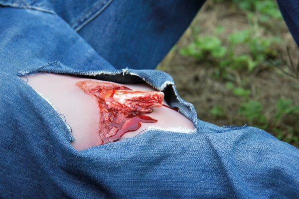 Wound Moulage with Bleeding Function