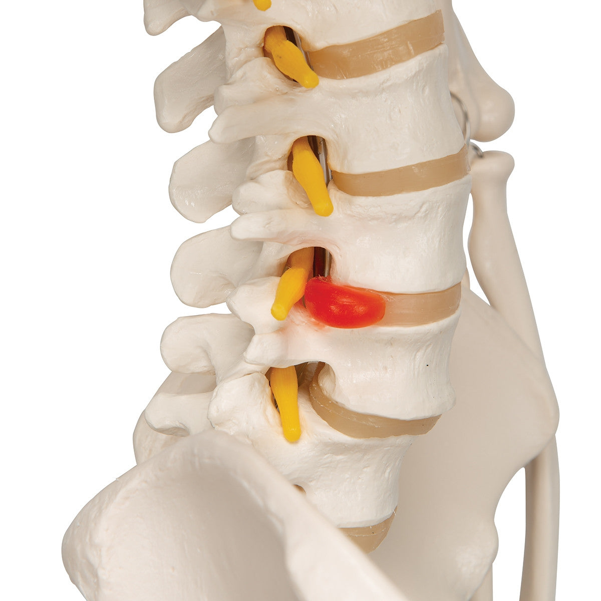 Fred Flexible Skeleton Model