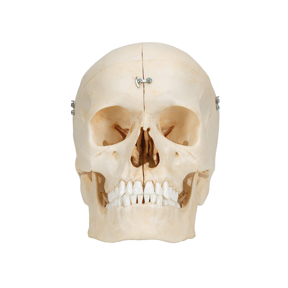 BONElike Skull Model (6 part)