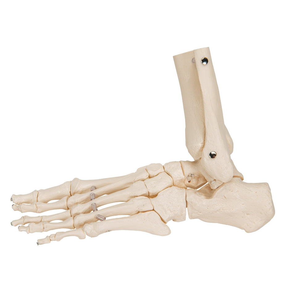 Loose Foot and Ankle Skeleton Model on Elastic