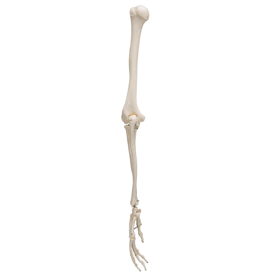 Arm Skeleton Model
