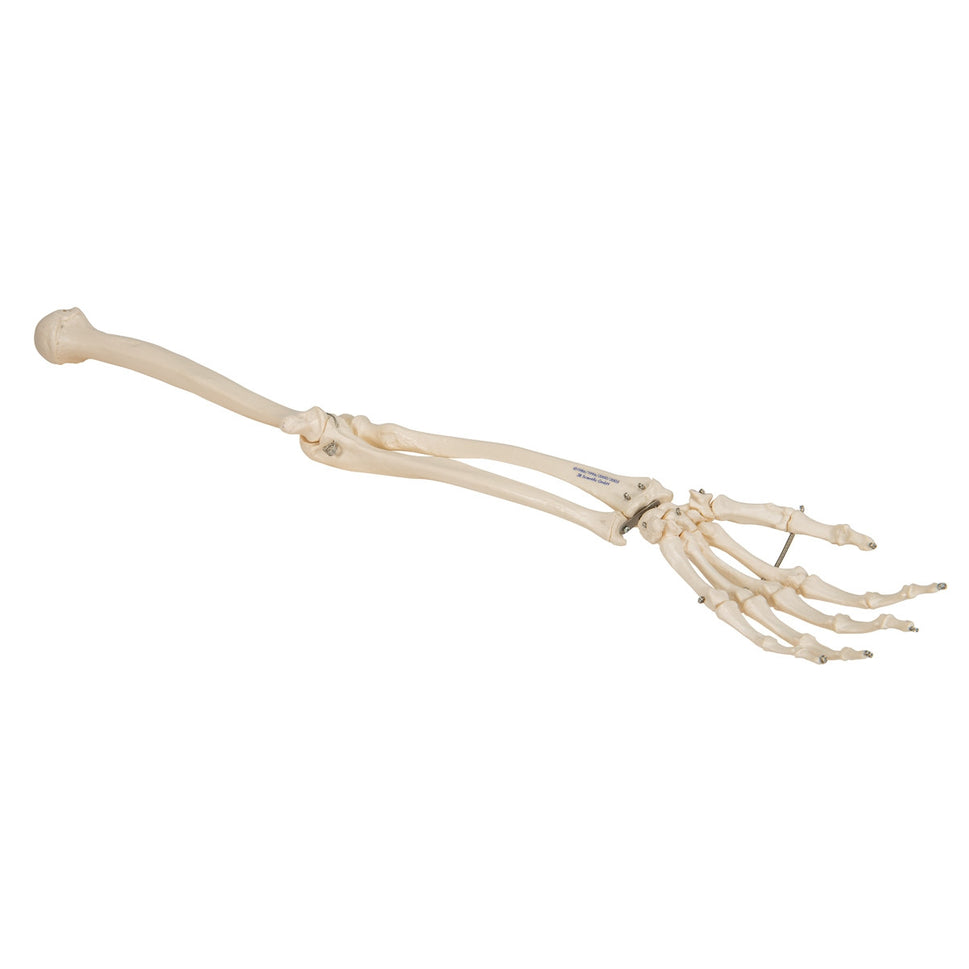 Arm Skeleton Model