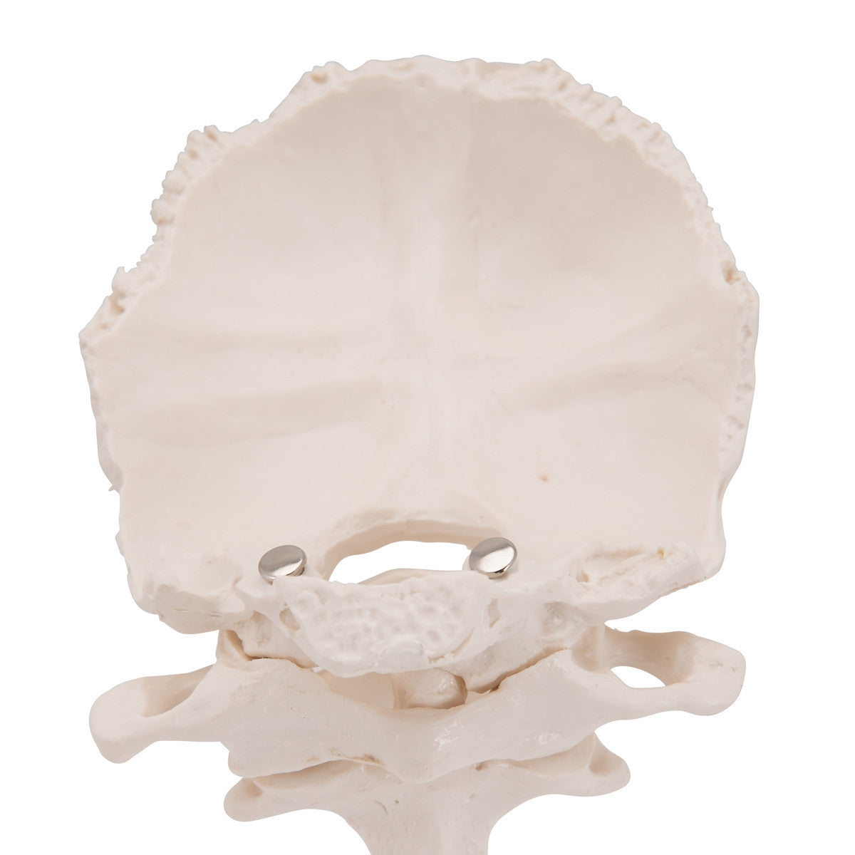 Atlas and Axis Model with Occipital Plate