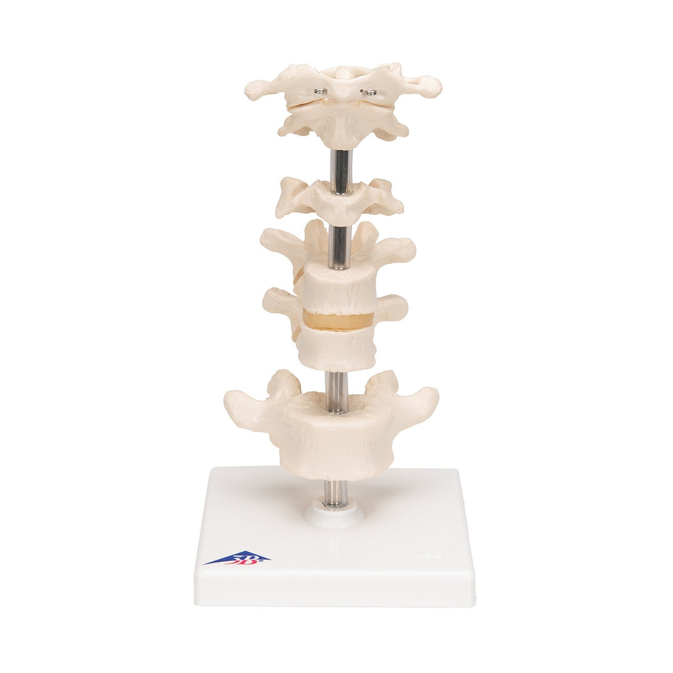 Mounted Vertebrae Model (6 part)