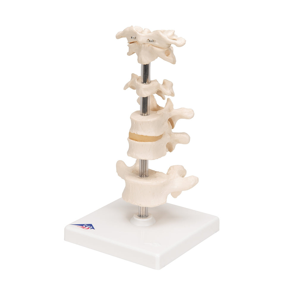 Mounted Vertebrae Model (6 part)