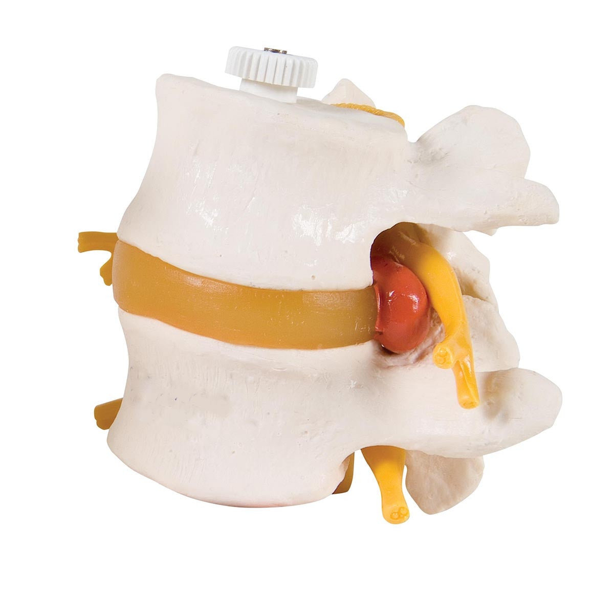 2 Lumbar Vertebrae Model with Prolapsed Disc (Flexibly Mounted)