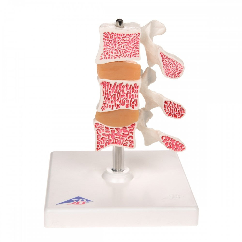 Osteoporosis Education Collection