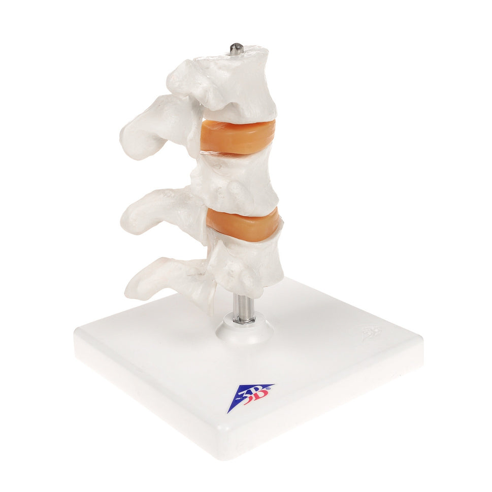 Osteoporosis Model (3 Vertebrae)
