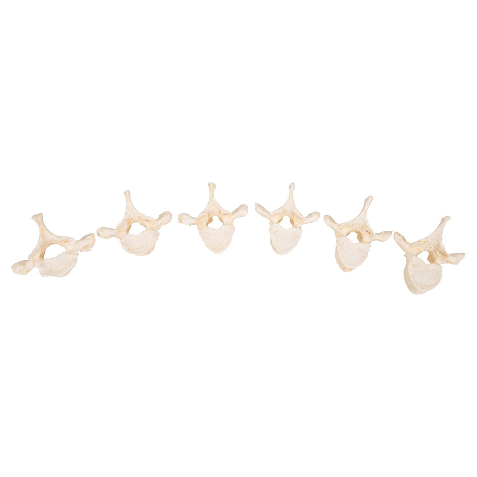 Set of 24 BONElike Vertebrae Models